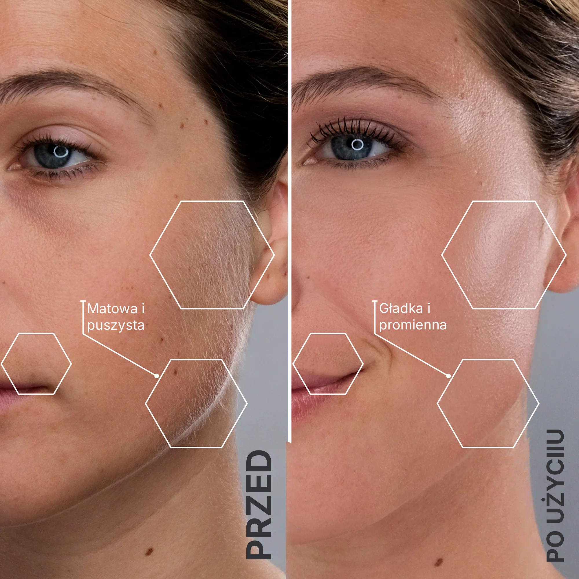 Soniczne urządzenie do dermaplaningu